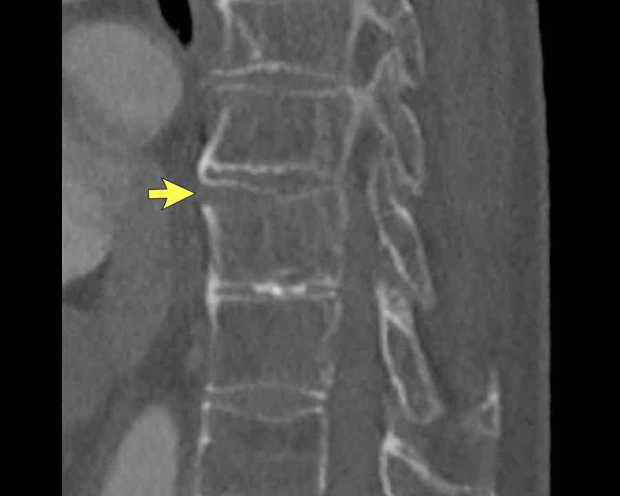 Slide 6