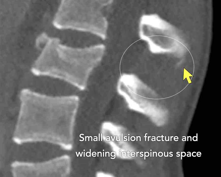 Slide 7