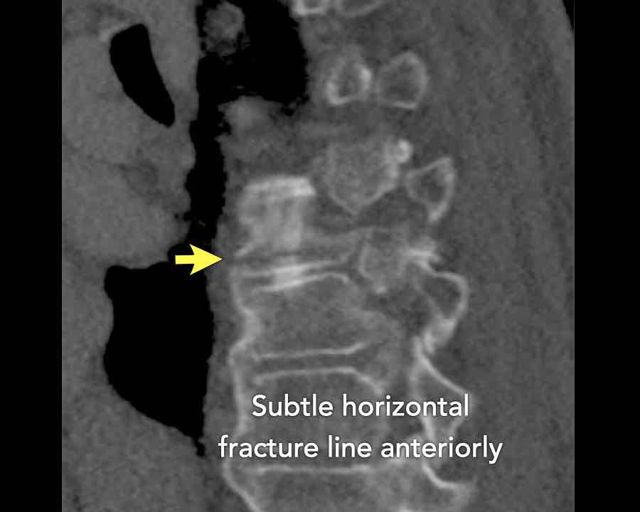 Slide 6
