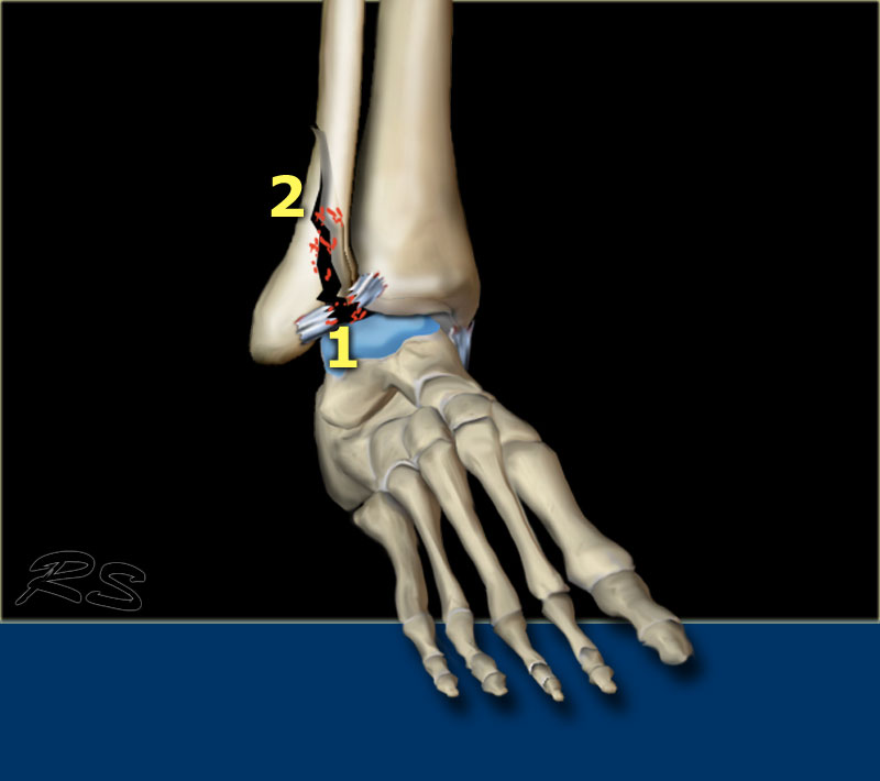 Slide 2