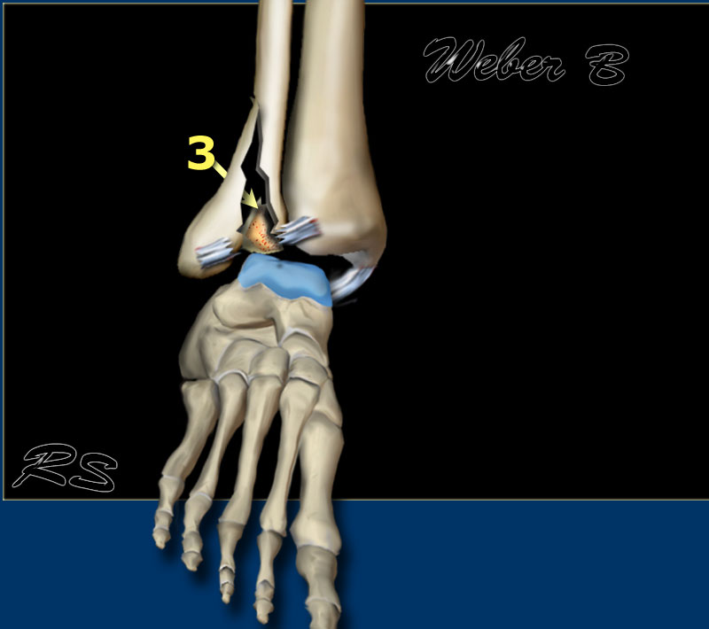 Slide 3