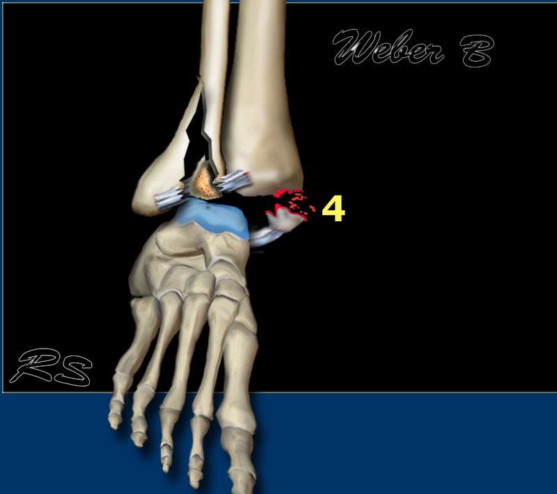 Slide 4