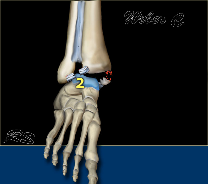 Slide 3