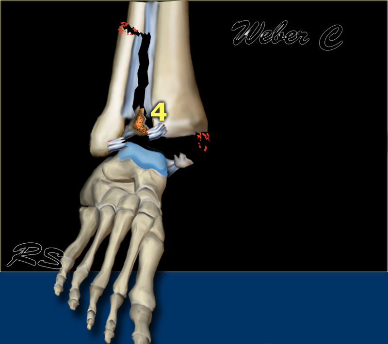 Slide 5
