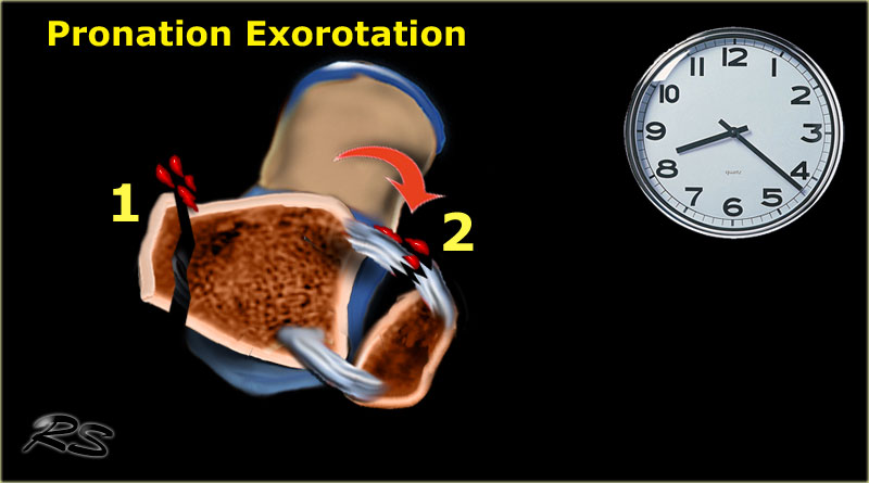 Slide 3