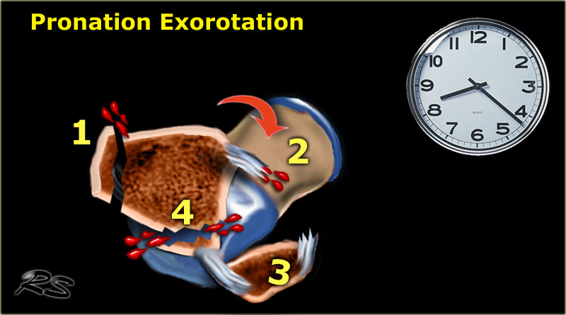 Slide 6