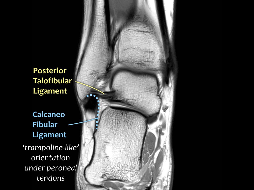 Slide 16
