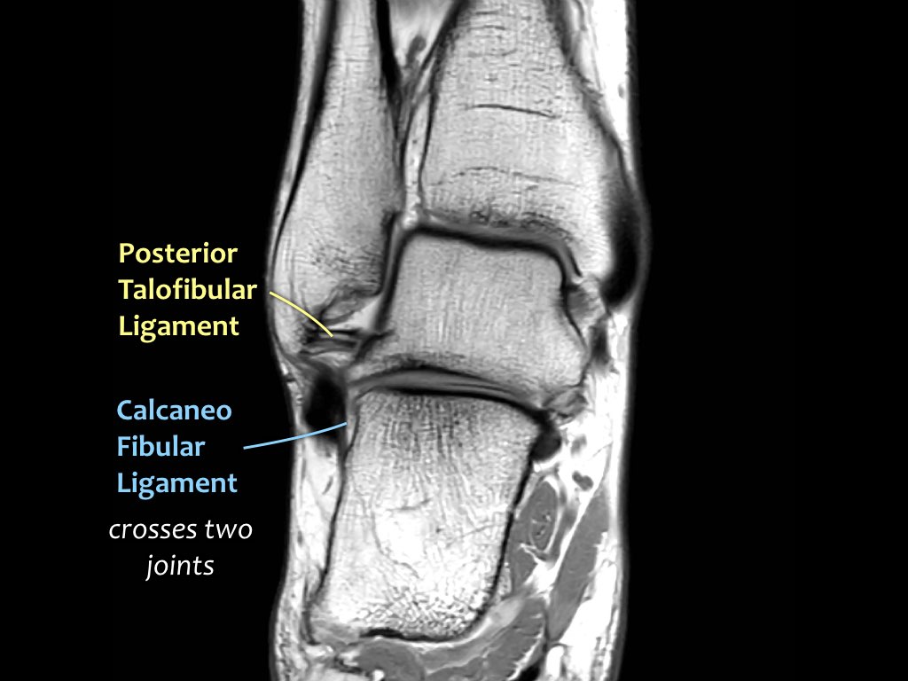 Slide 13