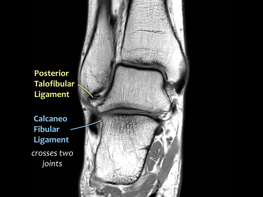 Slide 11