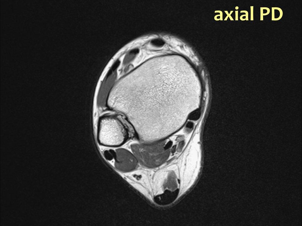 Slide 1