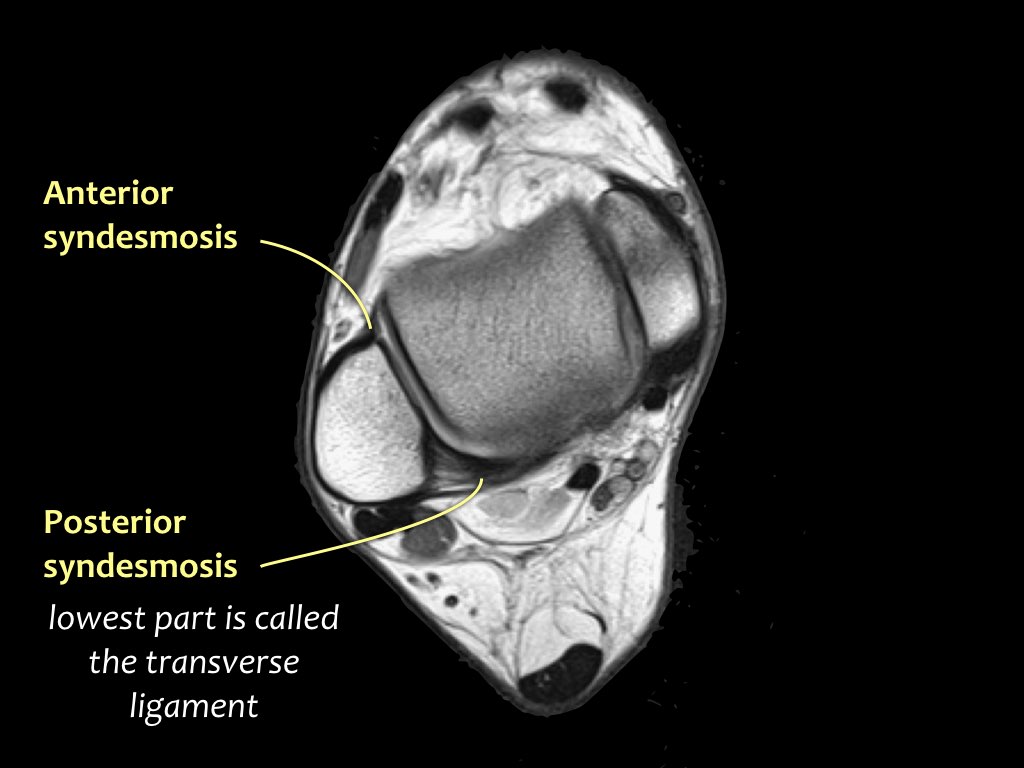 Slide 5