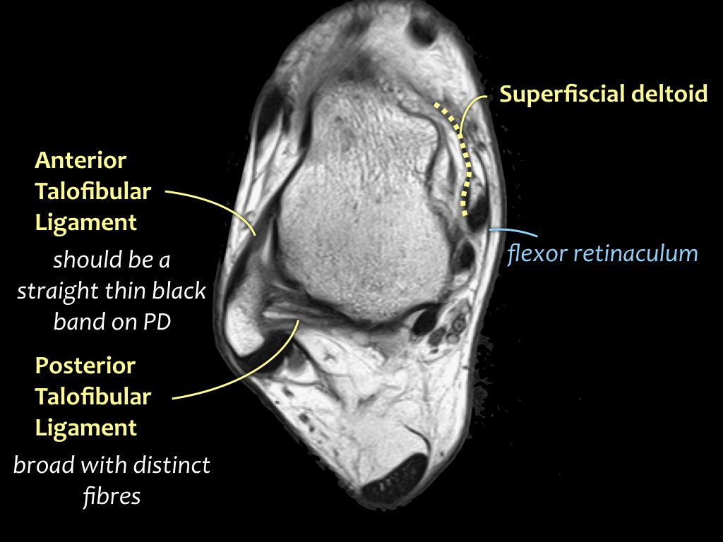 Slide 11