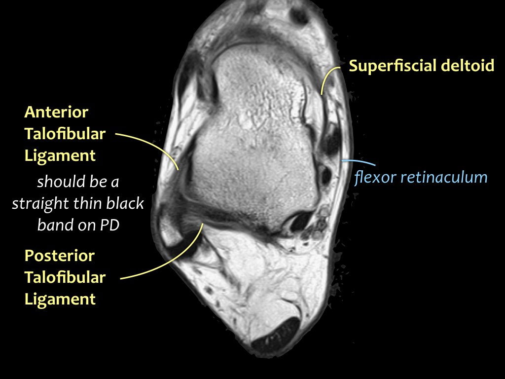 Slide 12
