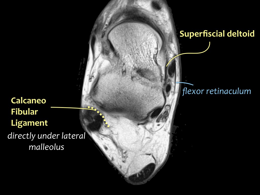 Slide 13