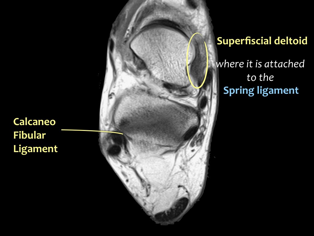Slide 15