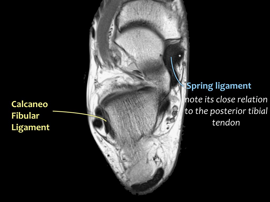 Slide 17