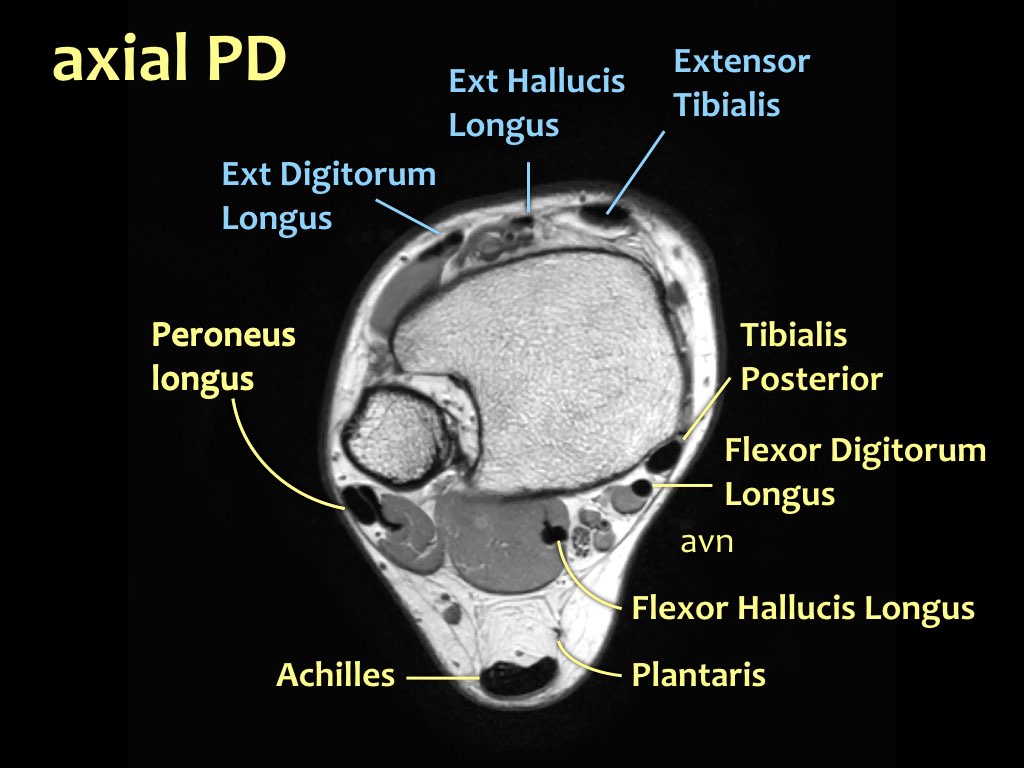 Slide 2