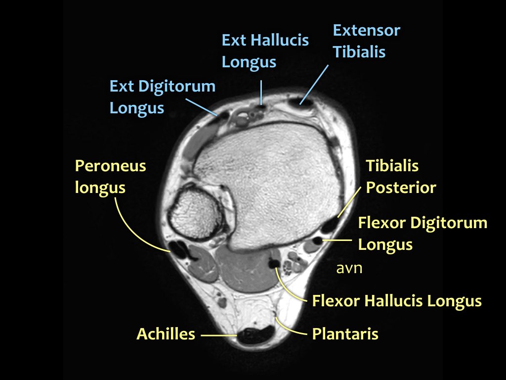 Slide 3