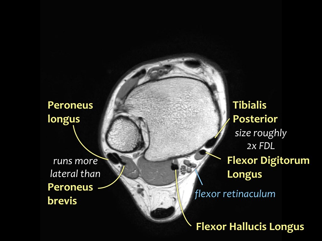 Slide 6
