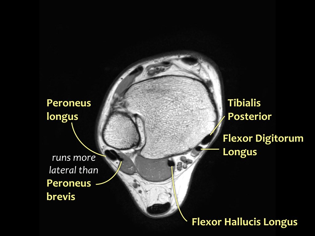 Slide 7