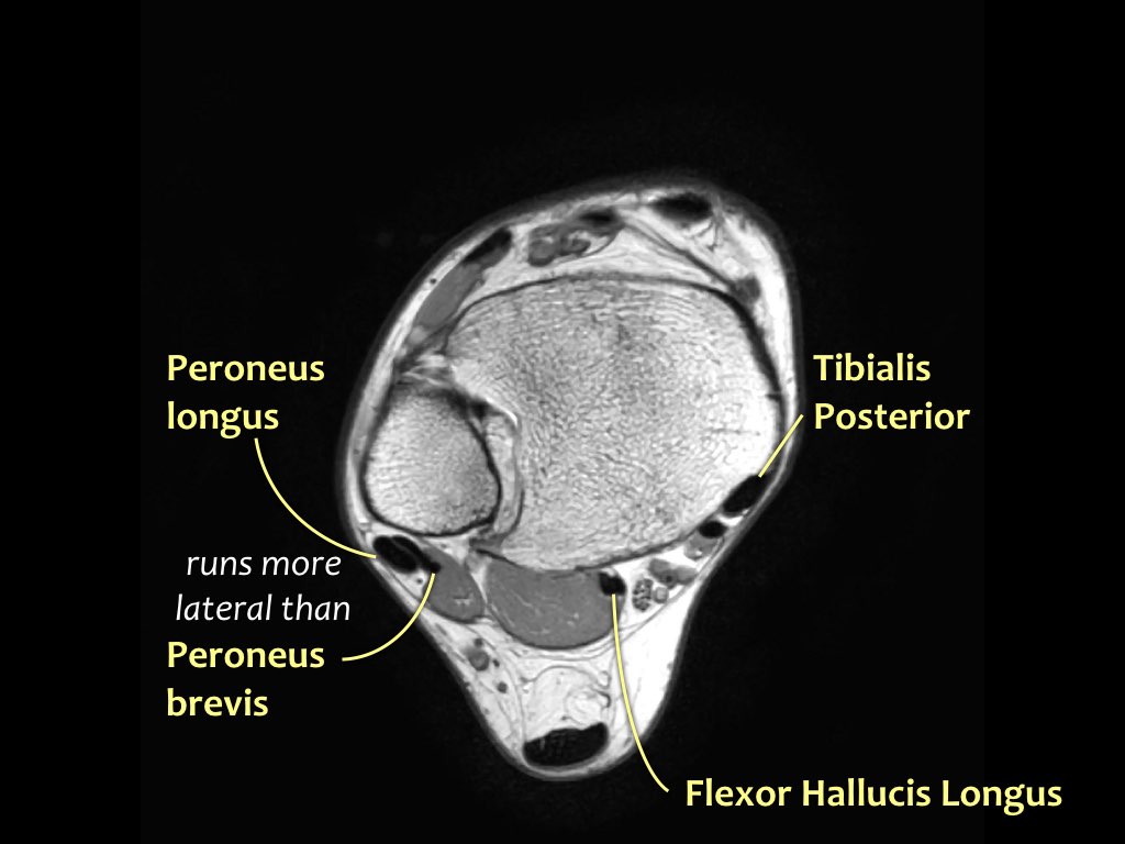 Slide 8