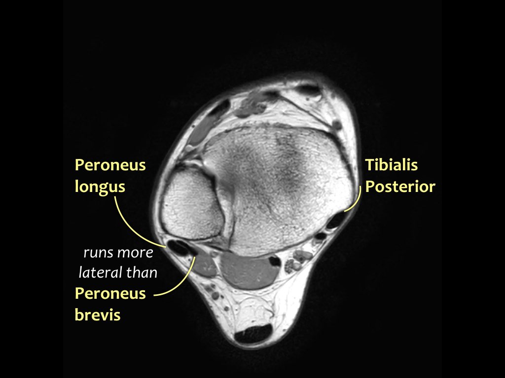 Slide 9
