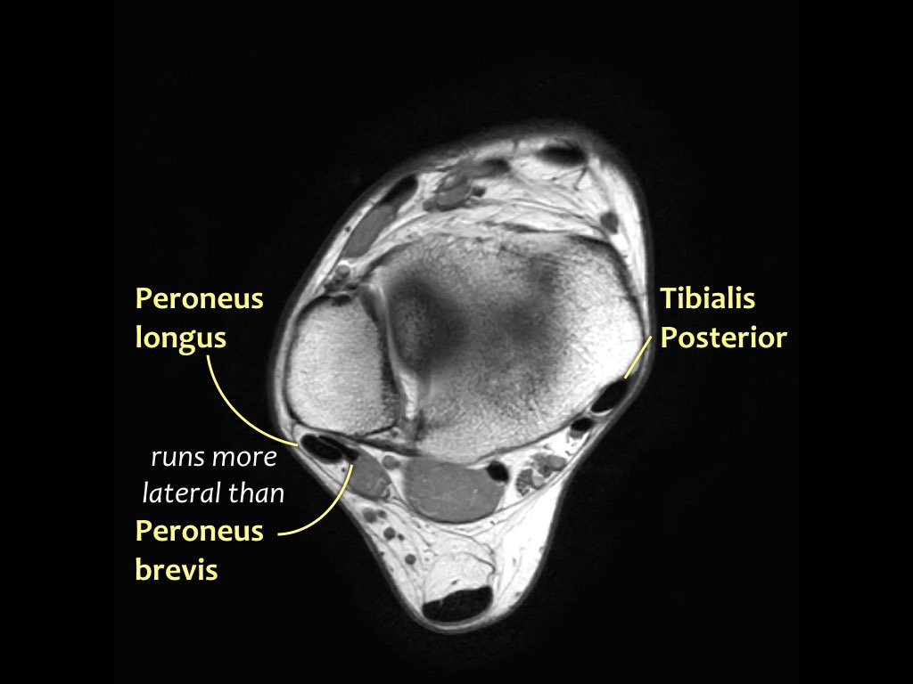 Slide 10