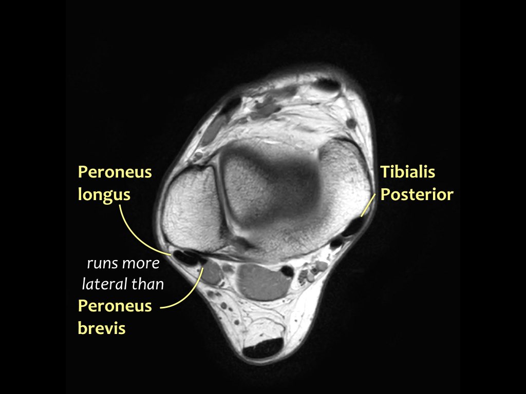 Slide 11