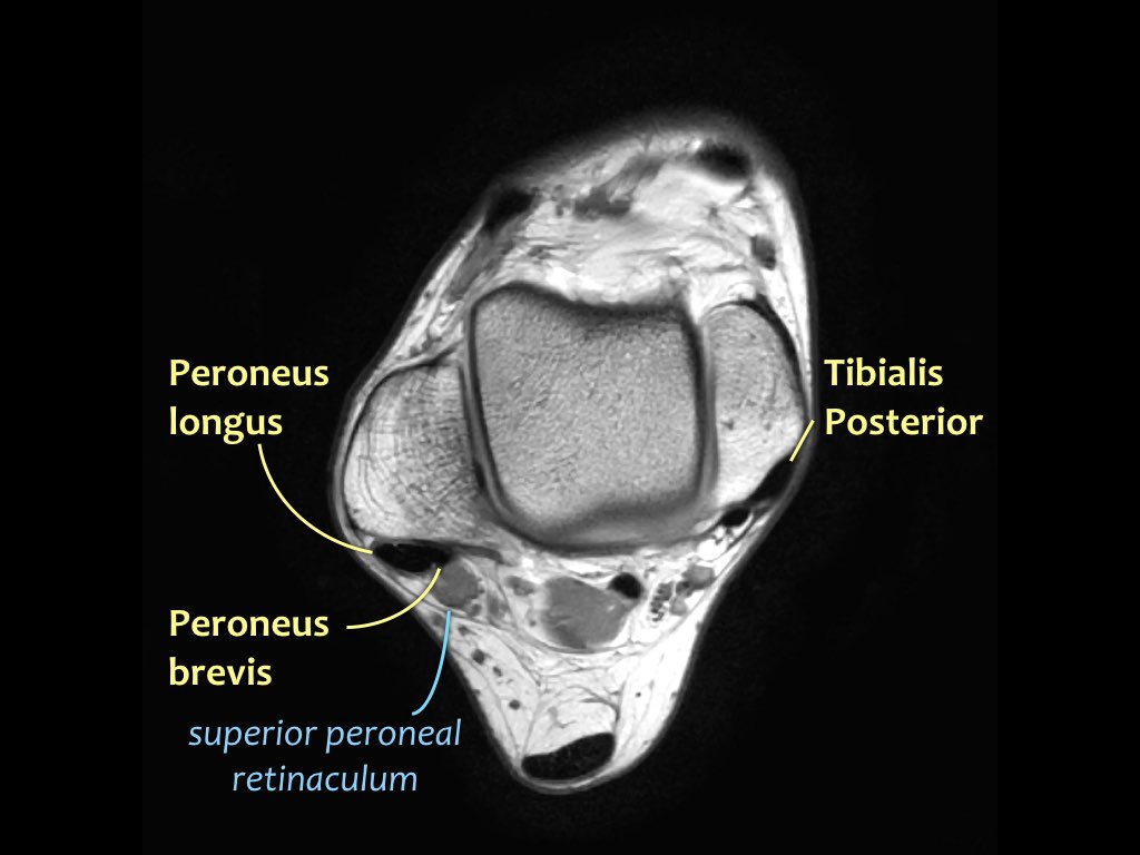 Slide 14