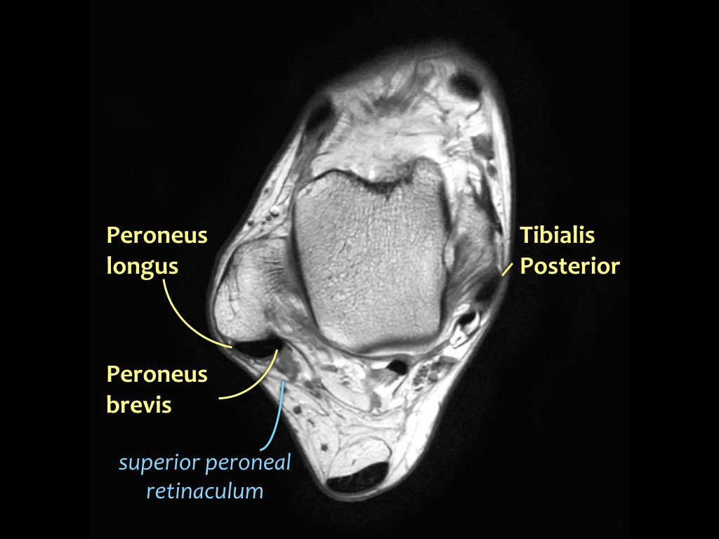 Slide 16