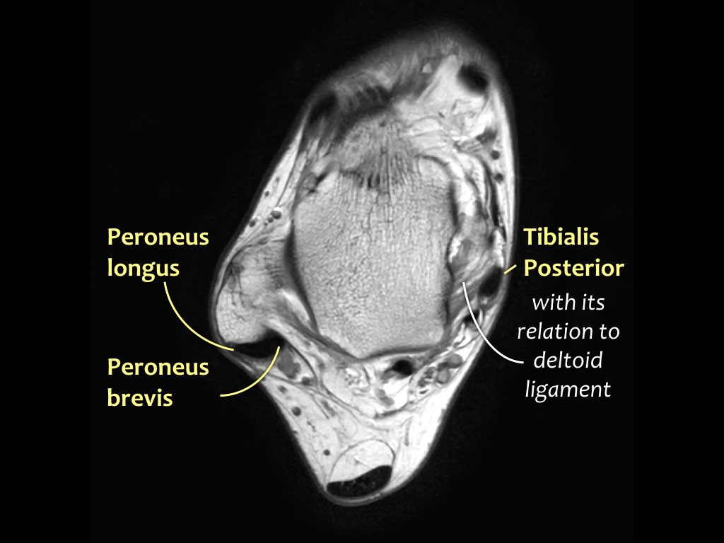 Slide 17
