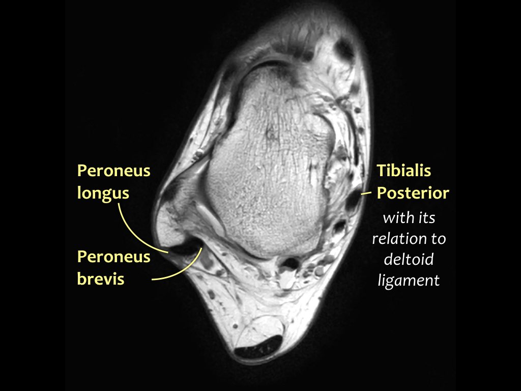 Slide 18