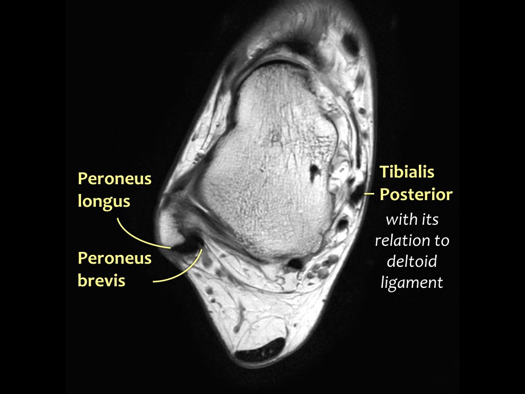 Slide 19