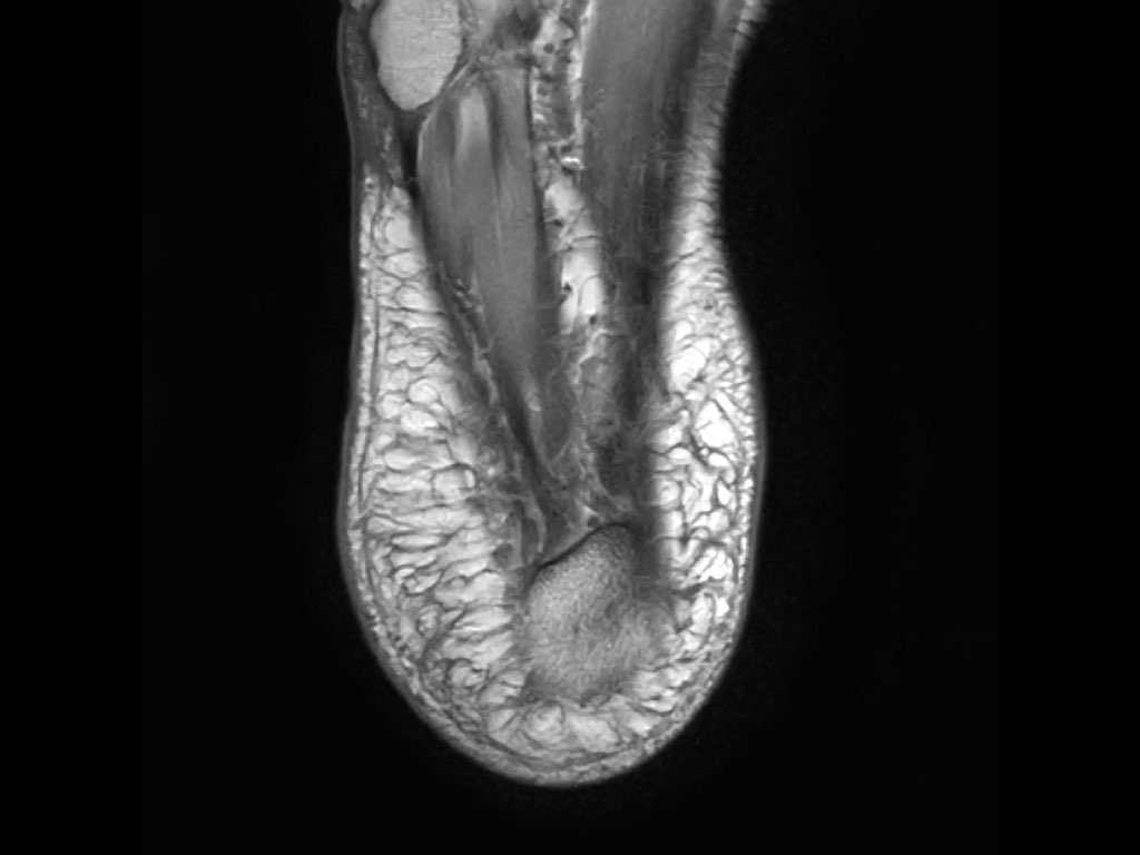 Slide 44