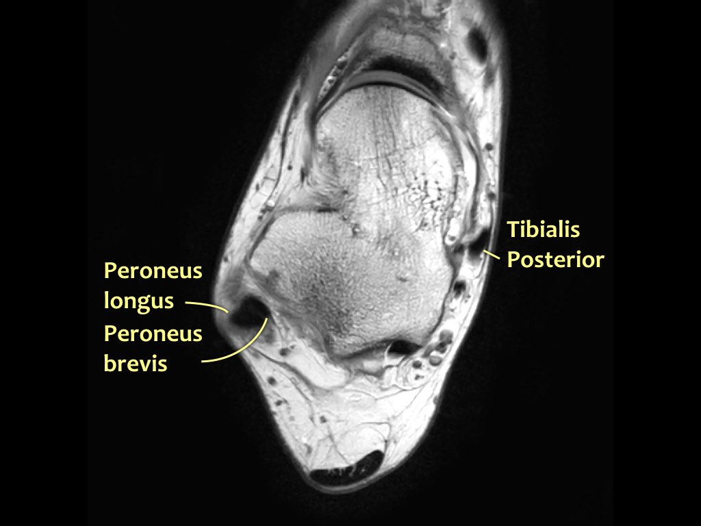 Slide 21