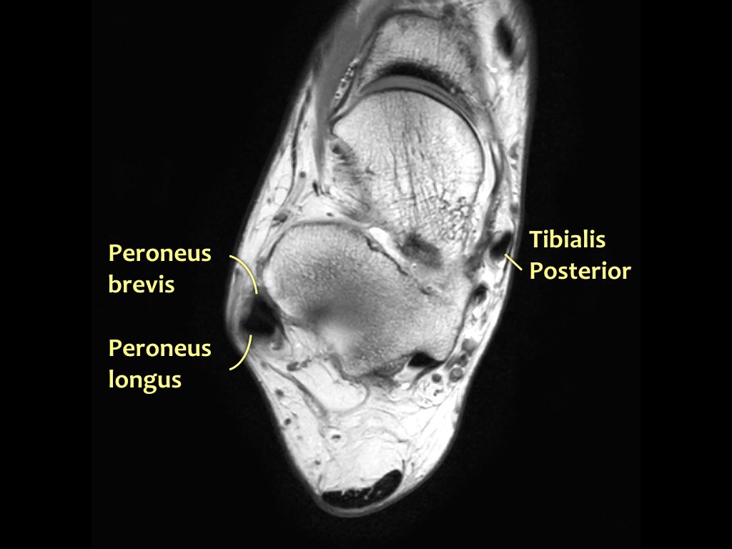 Slide 22