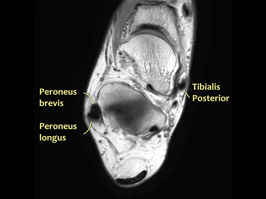 Slide 23