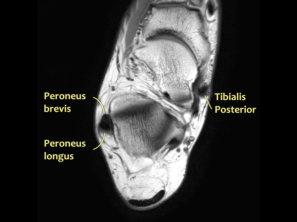 Slide 24