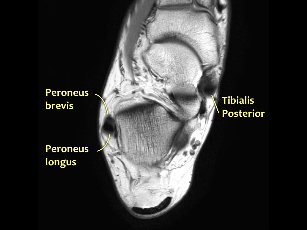 Slide 25