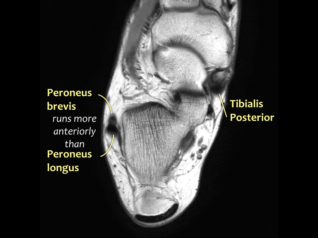 Slide 26