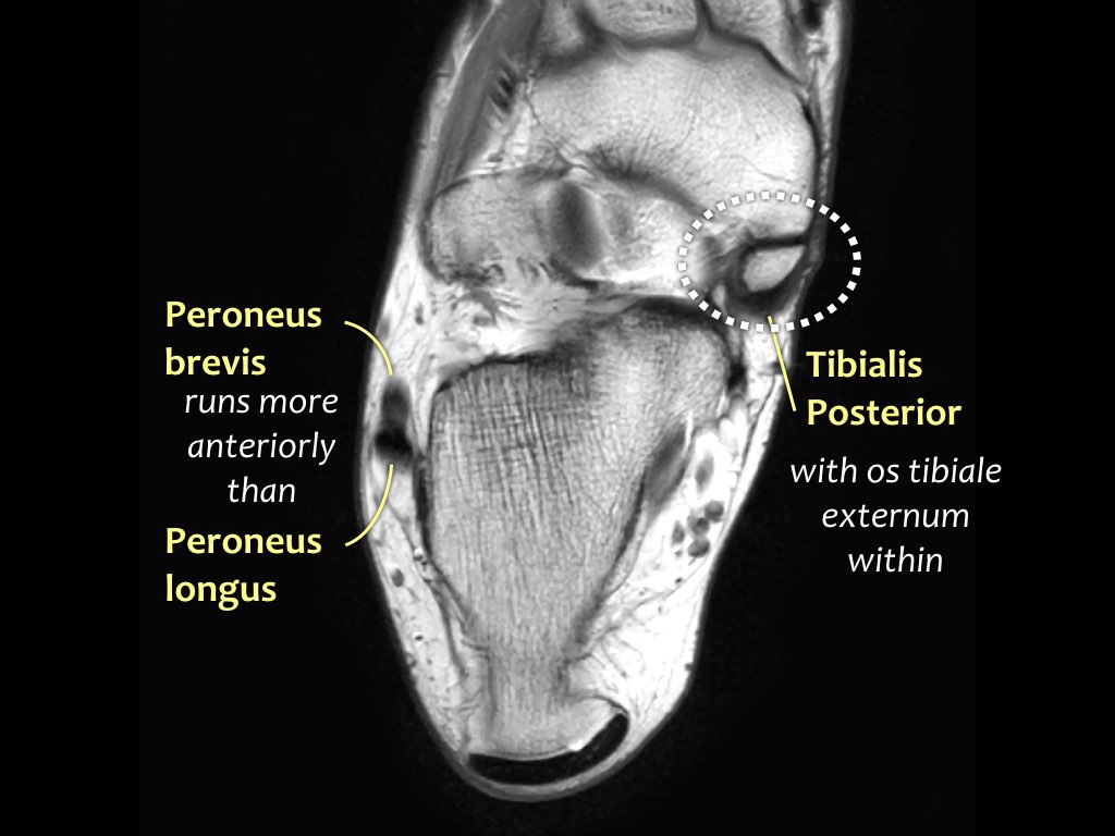 Slide 27