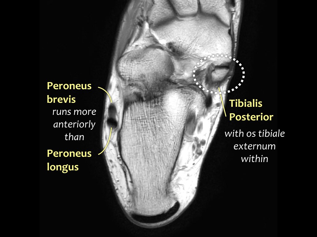 Slide 28