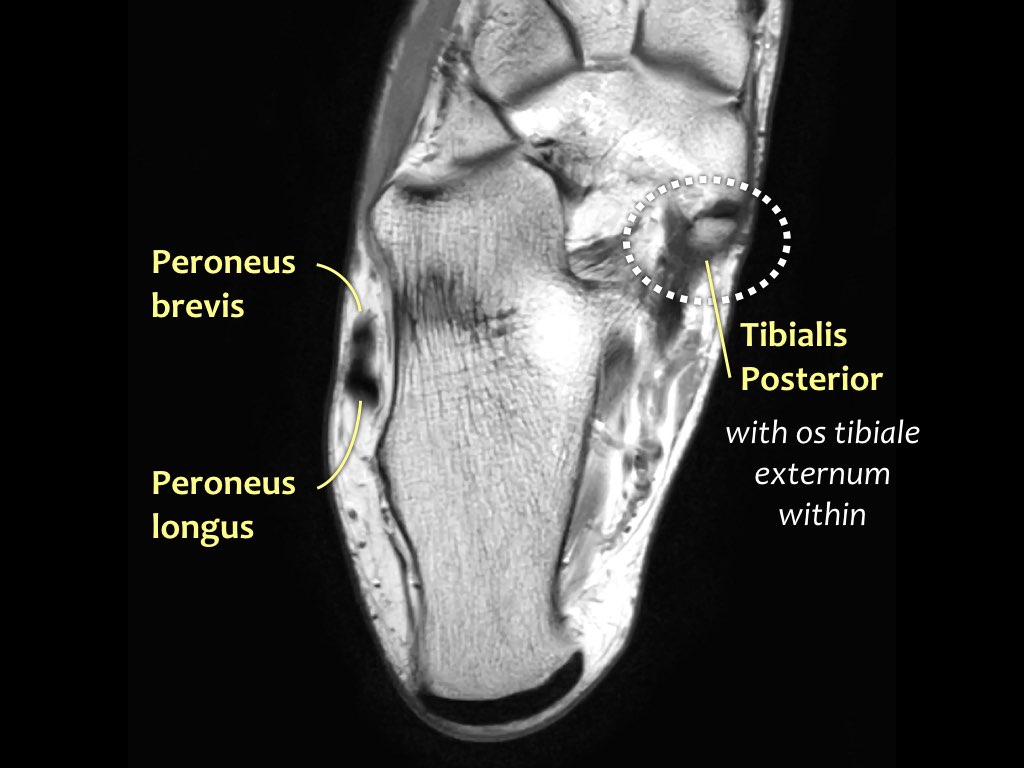 Slide 29