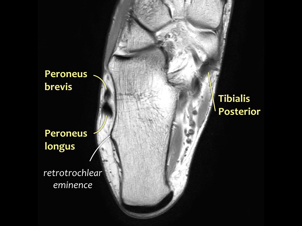 Slide 30