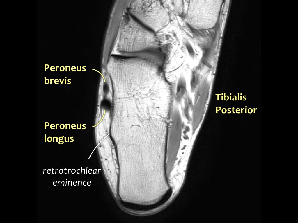 Slide 31