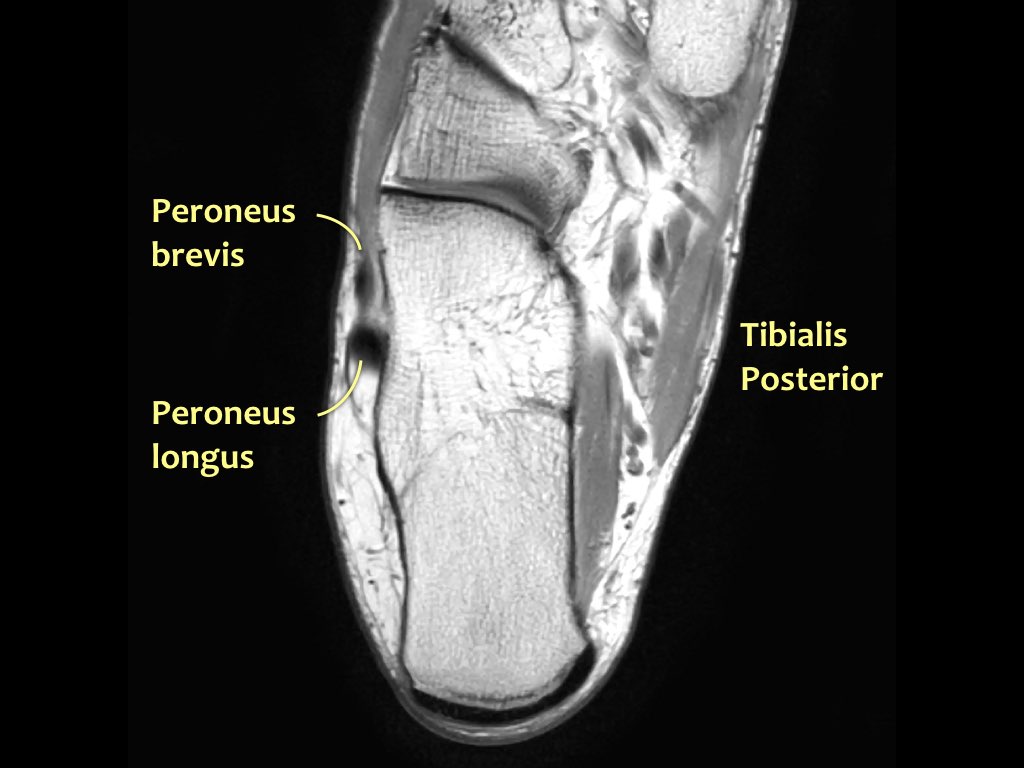 Slide 32