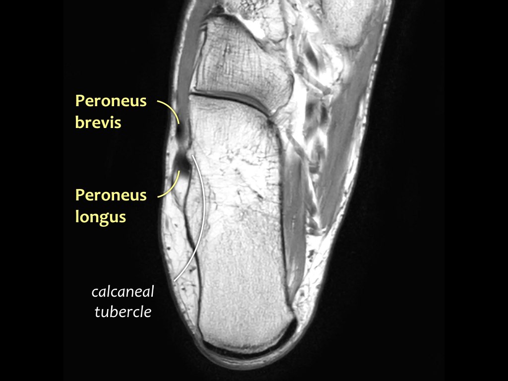 Slide 33
