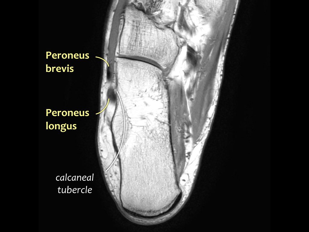 Slide 34