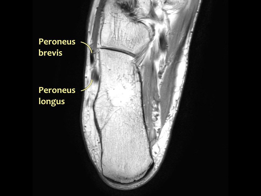 Slide 35