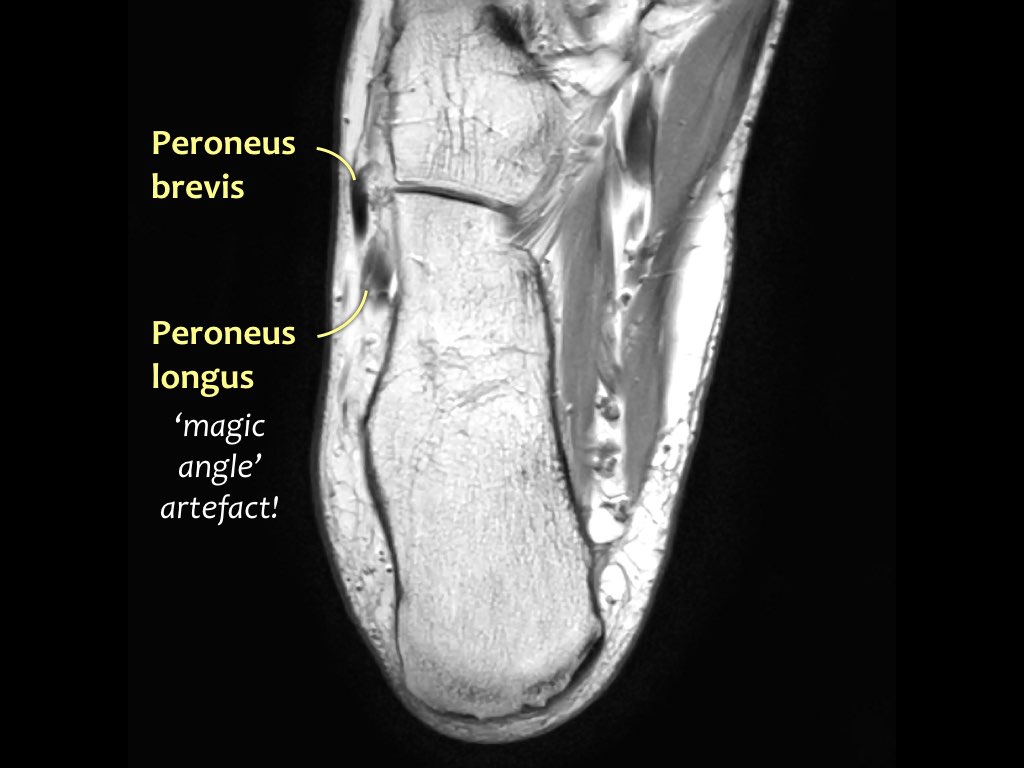 Slide 36